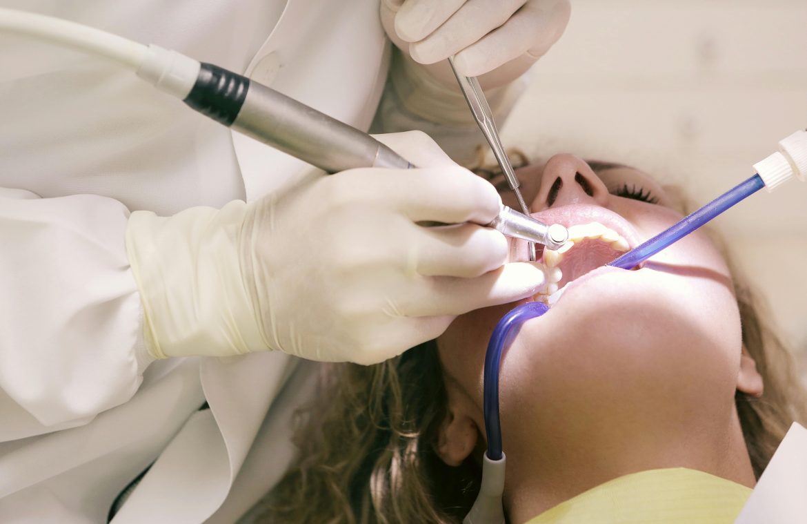 Tooth Extraction