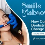 smile makeover