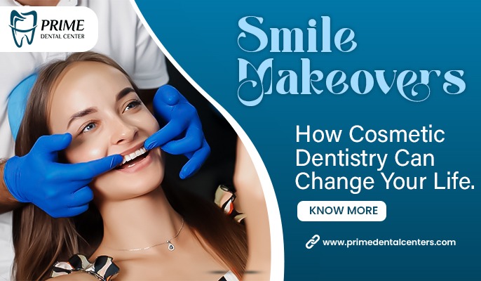 smile makeover