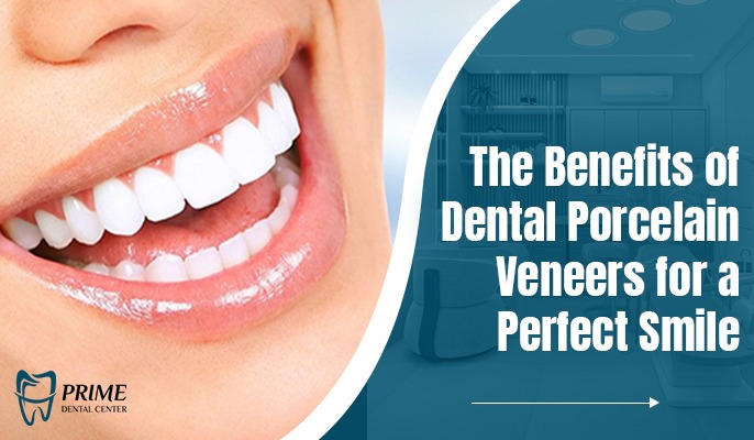 The Benefits of Dental Porcelain Veneers for a Perfect Smile