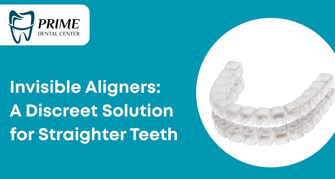 Invisible Aligners: A Discreet Solution for Straighter Teeth