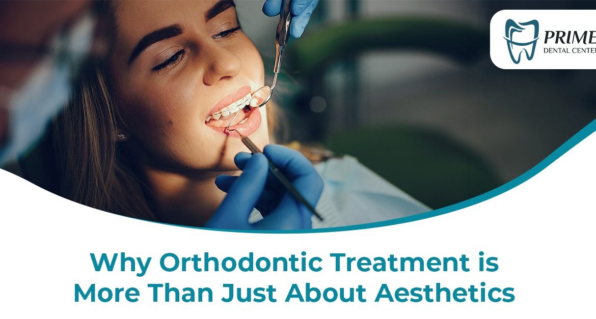 Why Orthodontic Treatment is More Than Just About Aesthetics