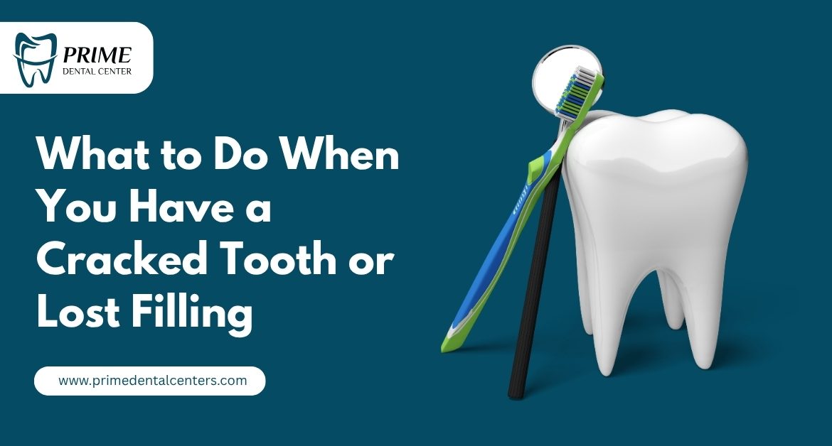 What to Do When You Have a Cracked Tooth or Lost Filling