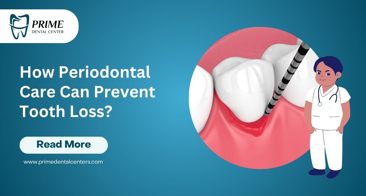 How Periodontal Care Can Prevent Tooth Loss