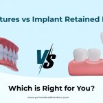 Full Dentures vs. Implant Retained Dentures