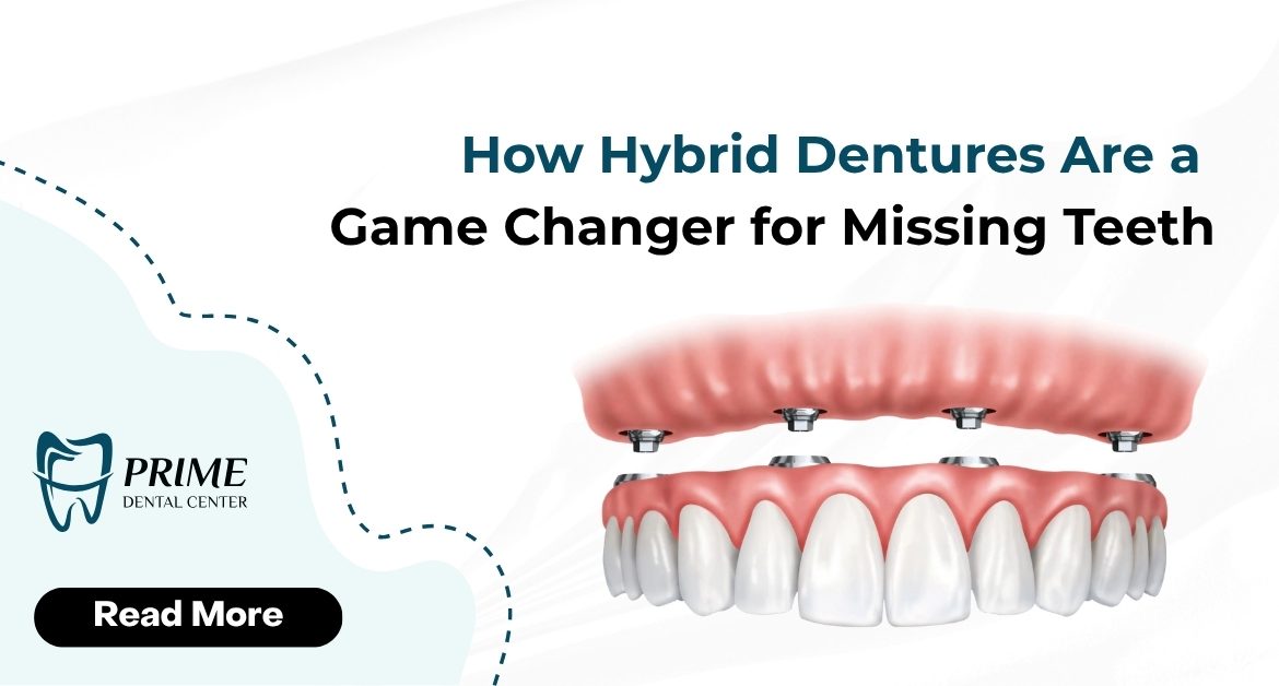 How Hybrid Dentures Are a Game Changer for Missing Teeth