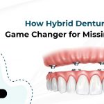How Hybrid Dentures Are a Game Changer for Missing Teeth