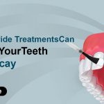 How Fluoride Treatments Can Protect Your Teeth from Decay