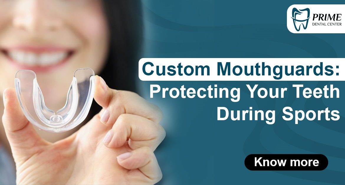 Custom Mouthguards: Protecting Your Teeth During Sports