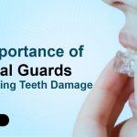 The Importance of Occlusal Guards in Preventing Teeth Damage