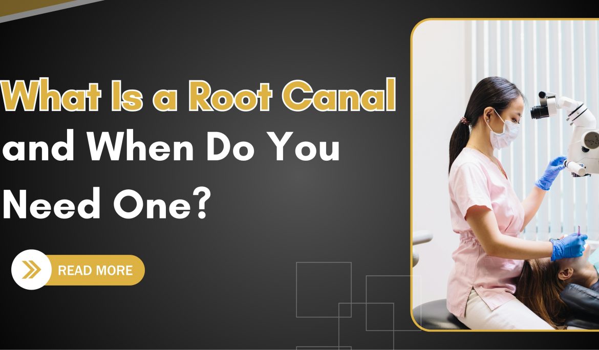 root canal treatment in Stratford