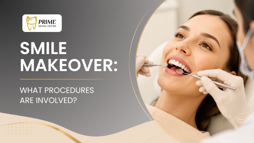 Smile Makeover: What Procedures Are Involved?