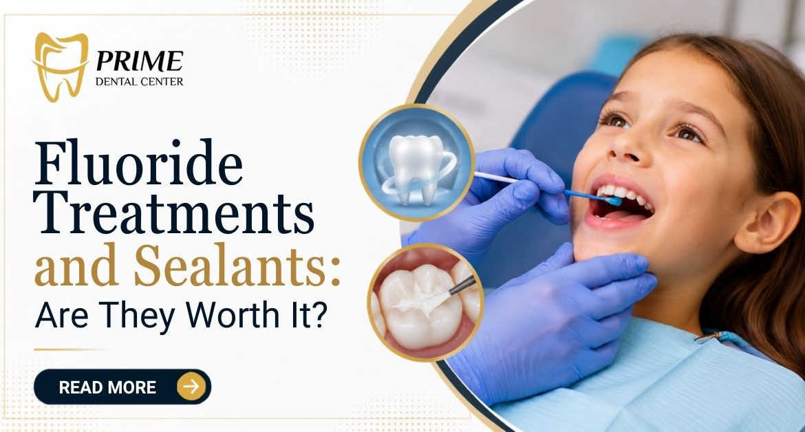 Fluoride Treatments and Sealants: Are They Worth It