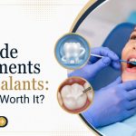 Fluoride Treatments and Sealants: Are They Worth It
