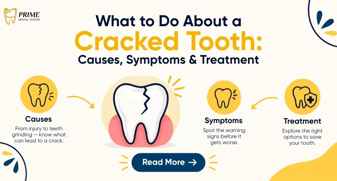 What to Do About a Cracked Tooth Causes, Symptoms & Treatment