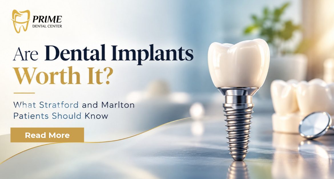 Are Dental Implants Worth It? What Stratford and Marlton Patients Should Know