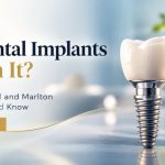 Are Dental Implants Worth It? What Stratford and Marlton Patients Should Know